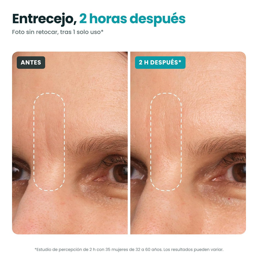 Peptide Skinjection™ Face & Eye Tape